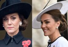 Did Kate Middleton Fake Cancer for a Secret Facelift?