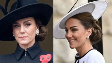 Did Kate Middleton Fake Cancer for a Secret Facelift?